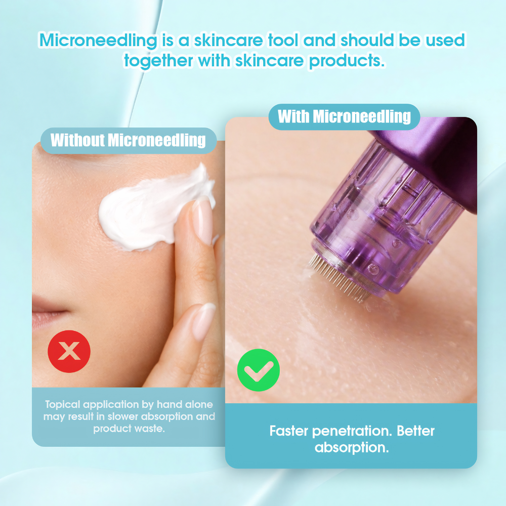 MAST 36 Pin Microneedle Dermapen kartuş iğneleri 10 Adet/Kutu